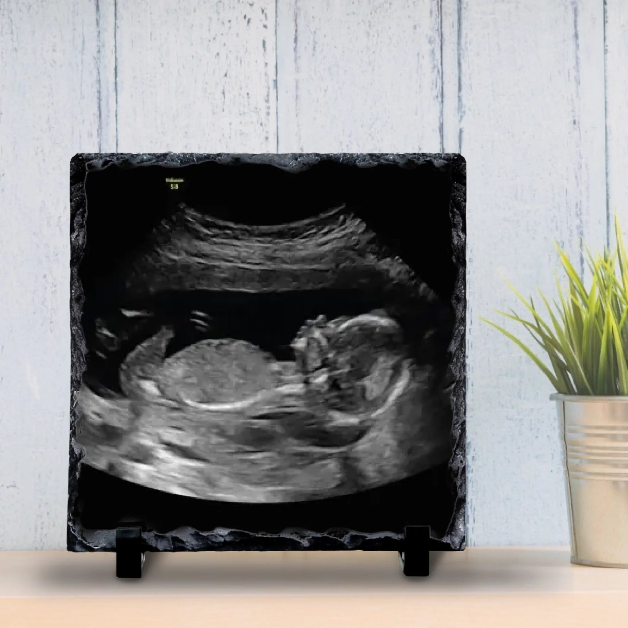 Custom Personalised Baby Scan Photo Slate | Ultrasound Photo Slate