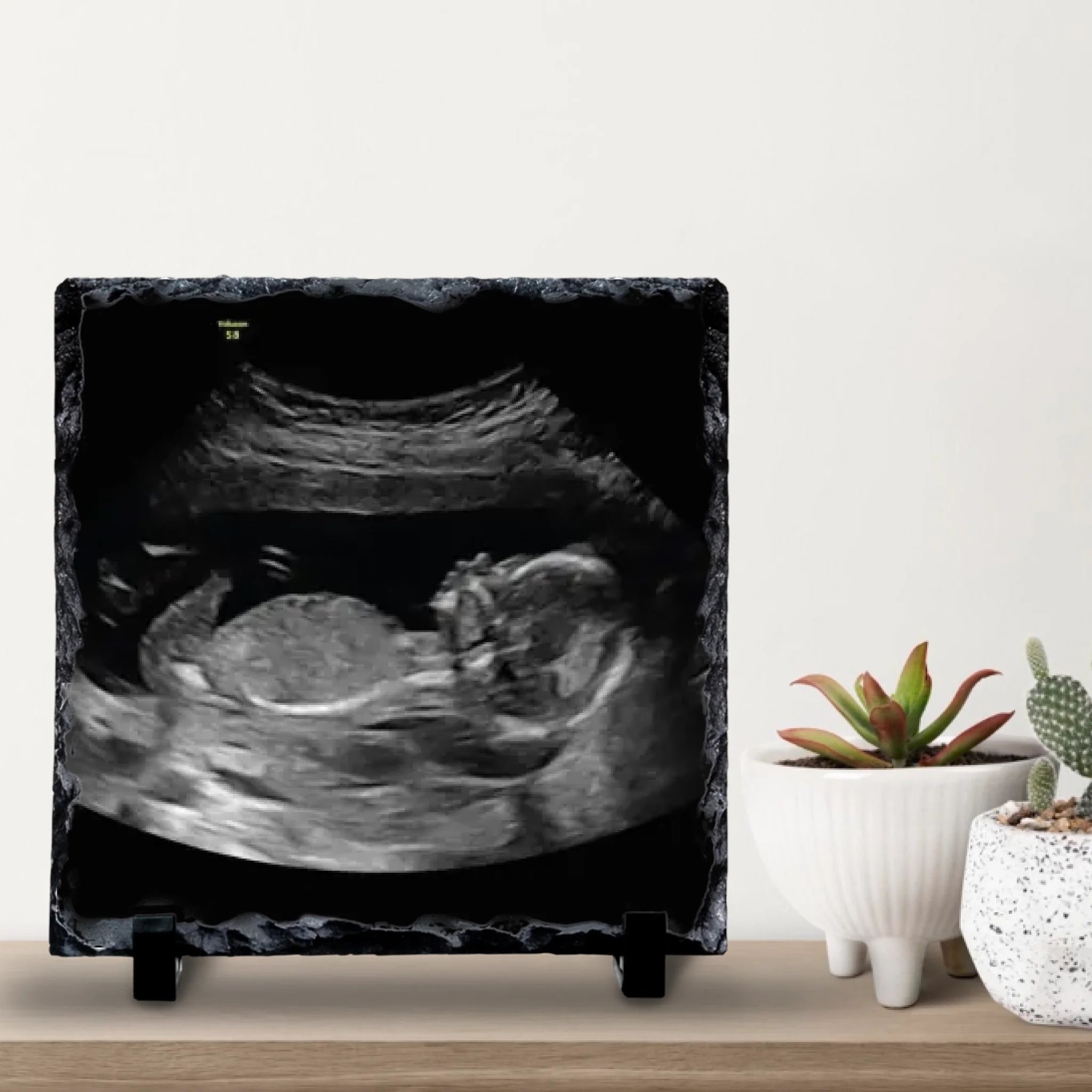 Custom Personalised Baby Scan Photo Slate | Ultrasound Photo Slate