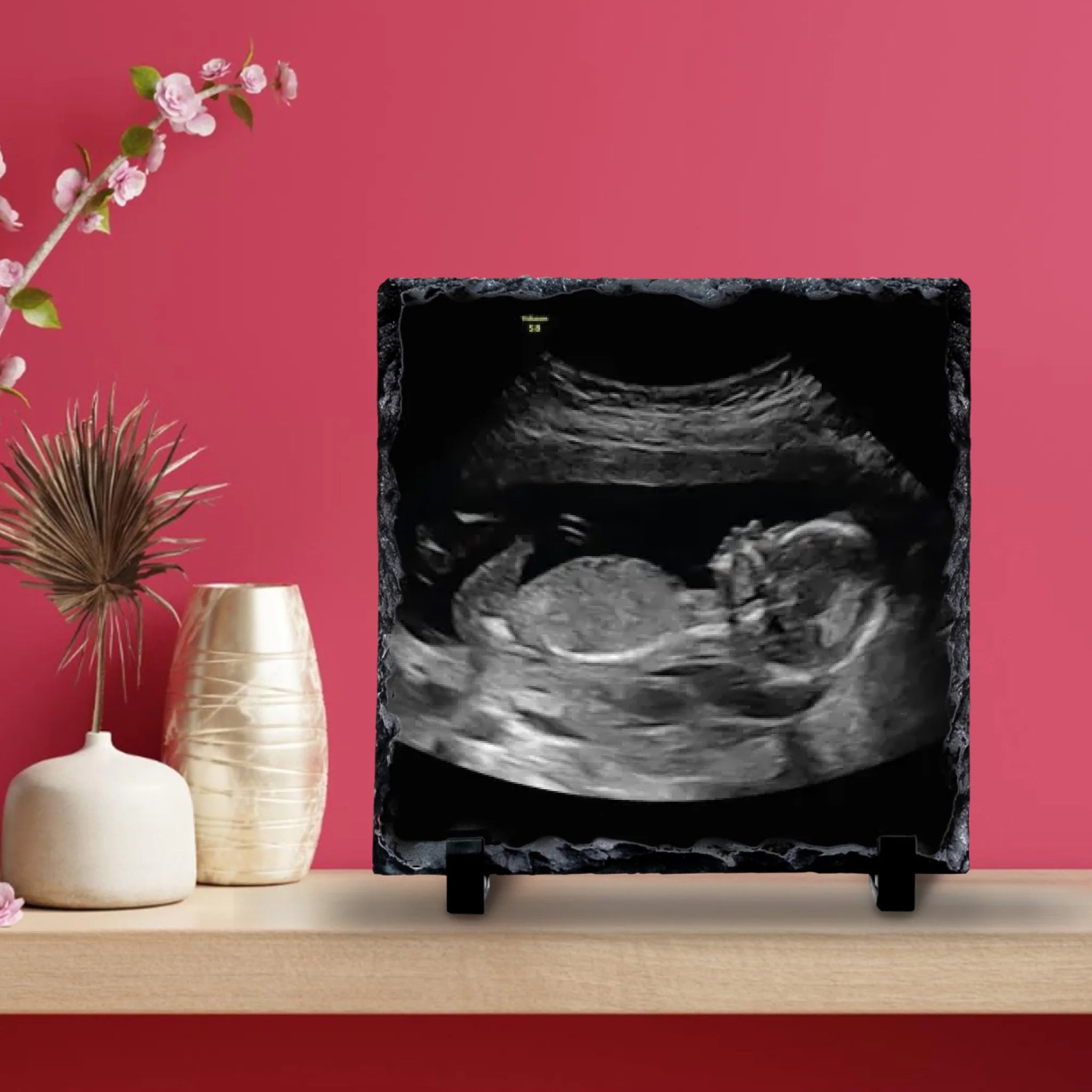 Custom Personalised Baby Scan Photo Slate | Ultrasound Photo Slate