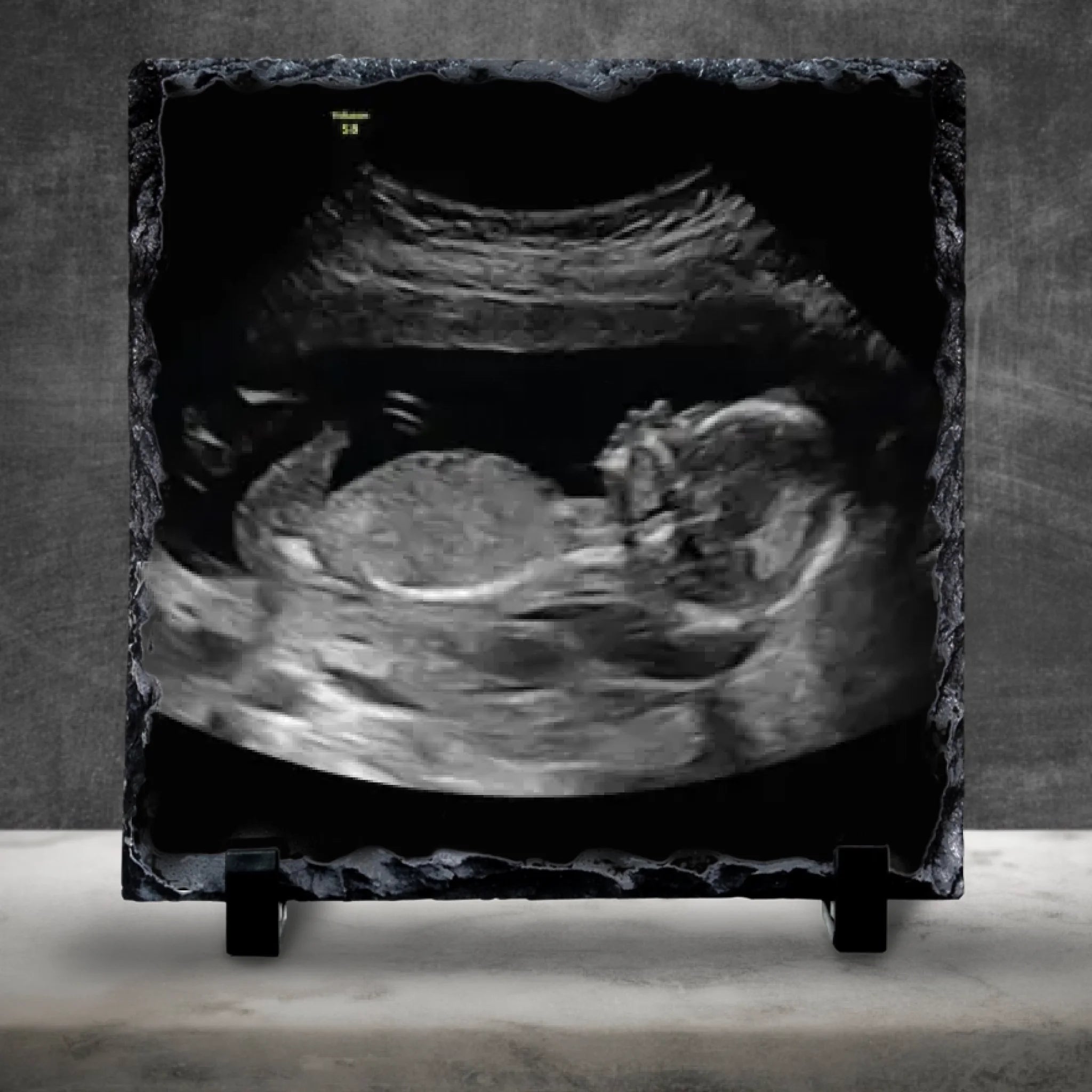 Custom Personalised Baby Scan Photo Slate | Ultrasound Photo Slate