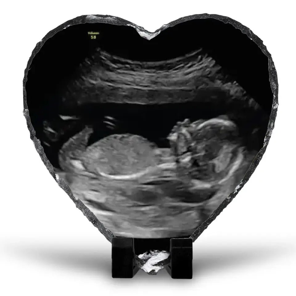 Custom Personalised Baby Scan Heart Photo Slate | Ultrasound Photo Slate