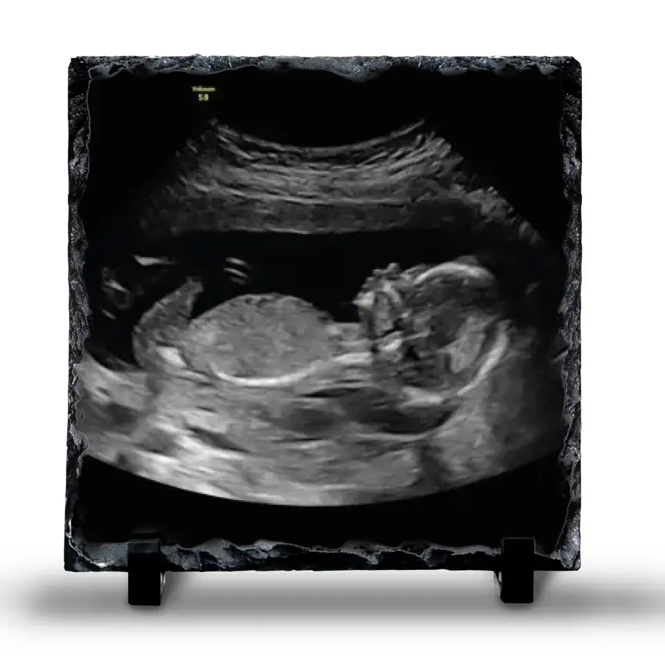 Custom Personalised Baby Scan Photo Slate | Ultrasound Photo Slate