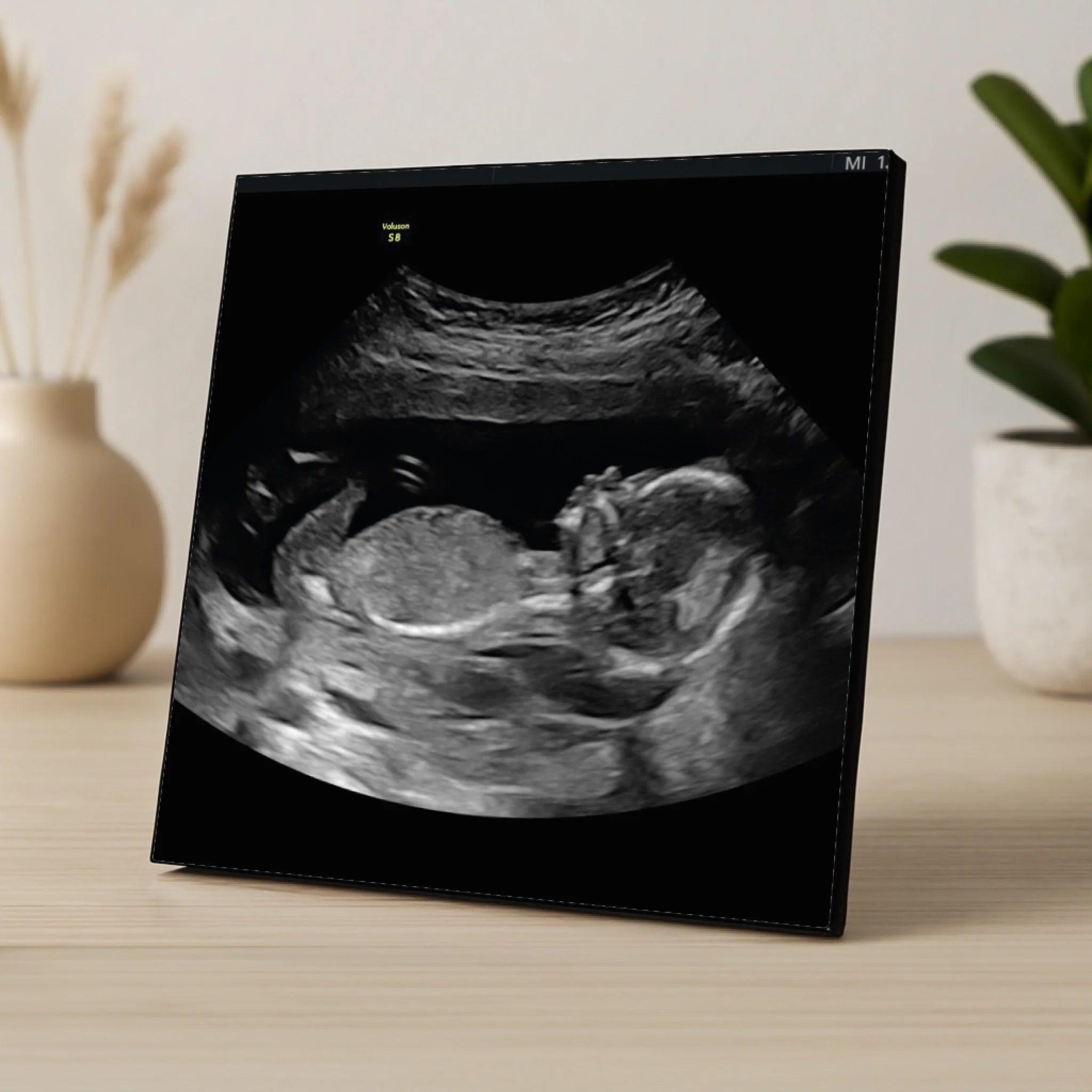 Custom Personalised Baby Scan Photo Panel | Ultrasound Photo Plaque