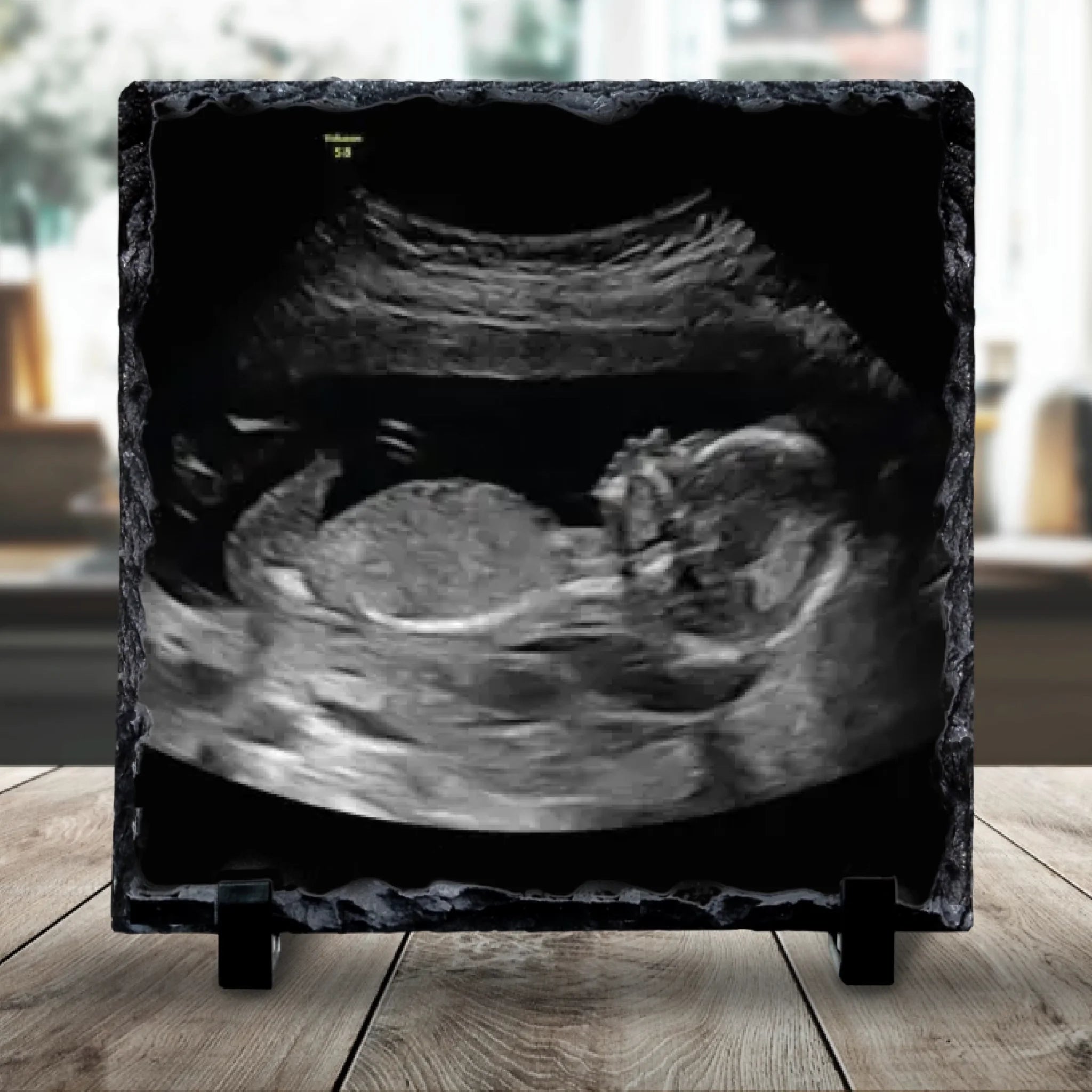 Custom Personalised Baby Scan Photo Slate | Ultrasound Photo Slate