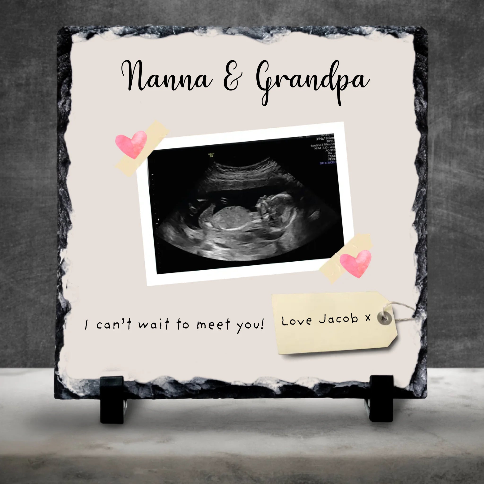 Personalised Baby Scan Photo Slate - Custom Gift for Grandparents, Relatives or Friends